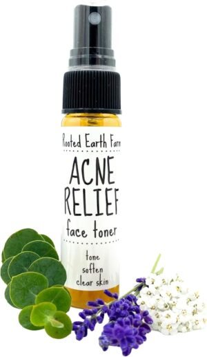 Acne Relief Face Toner – 1 fl oz – Facial Toning Spray – Herbal